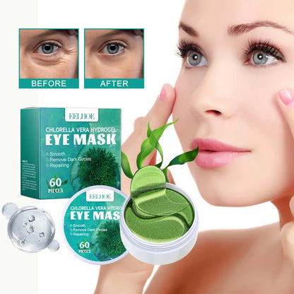 Hydrogel Under-Eye Patches before and after - reduces puffiness and dark circles - SmartUz Wellness